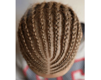 SCALP TREATMENTS